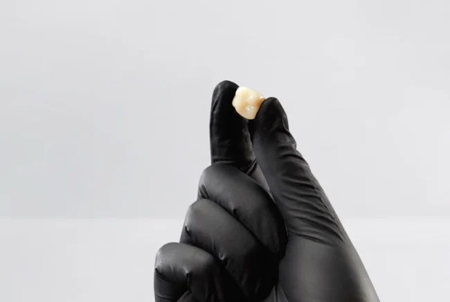 Couronne imprimée avec la Ceramix-Nano Couronne imprimée avec la Ceramix-Nano